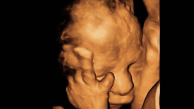 Ultrassonografia bebê